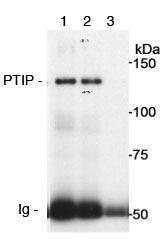Immunoprecipitation - Anti-PTIP antibody (AB70434), expandable thumbnail