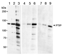 Western blot - Anti-PTIP antibody (AB70434), expandable thumbnail