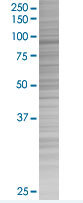 PTIP overexpression 293T lysate (whole cell)