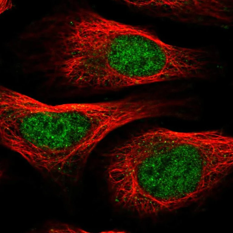Immunocytochemistry/ Immunofluorescence - Anti-PTMA antibody (AB247074)