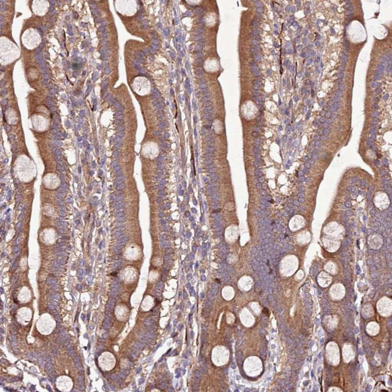 Immunohistochemistry (Formalin/PFA-fixed paraffin-embedded sections) - Anti-PTMA antibody (AB247074)