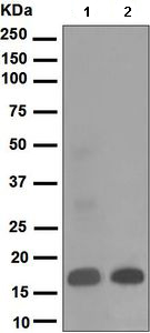 Western blot - Anti-PTN antibody [EP3040(2)] (AB133517), expandable thumbnail