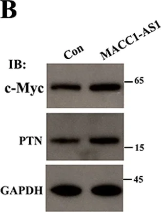 Western blot - Anti-PTN antibody [EP3040(2)] (AB133517)