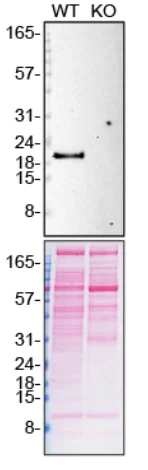 Western blot - Anti-PTN antibody [EP3040(2)] - BSA and Azide free (AB284804)
