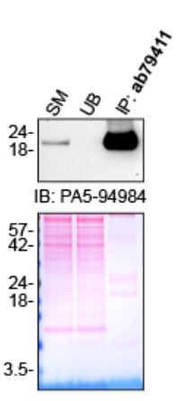 Immunoprecipitation - Anti-PTN antibody [EPR3041] (AB79411), expandable thumbnail