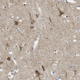 Immunohistochemistry (Formalin/PFA-fixed paraffin-embedded sections) - Anti-PTP zeta/ Phosphacan antibody (AB126497), expandable thumbnail