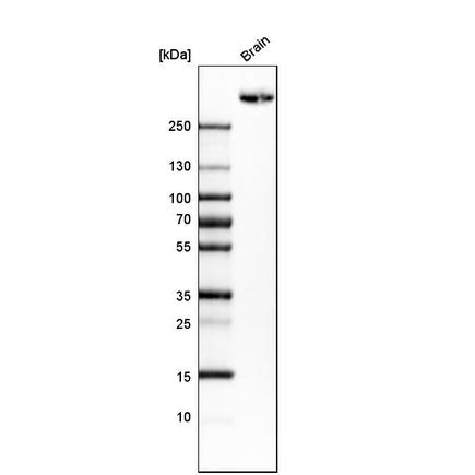 Western blot - Anti-PTP zeta/ Phosphacan antibody (AB126497), expandable thumbnail