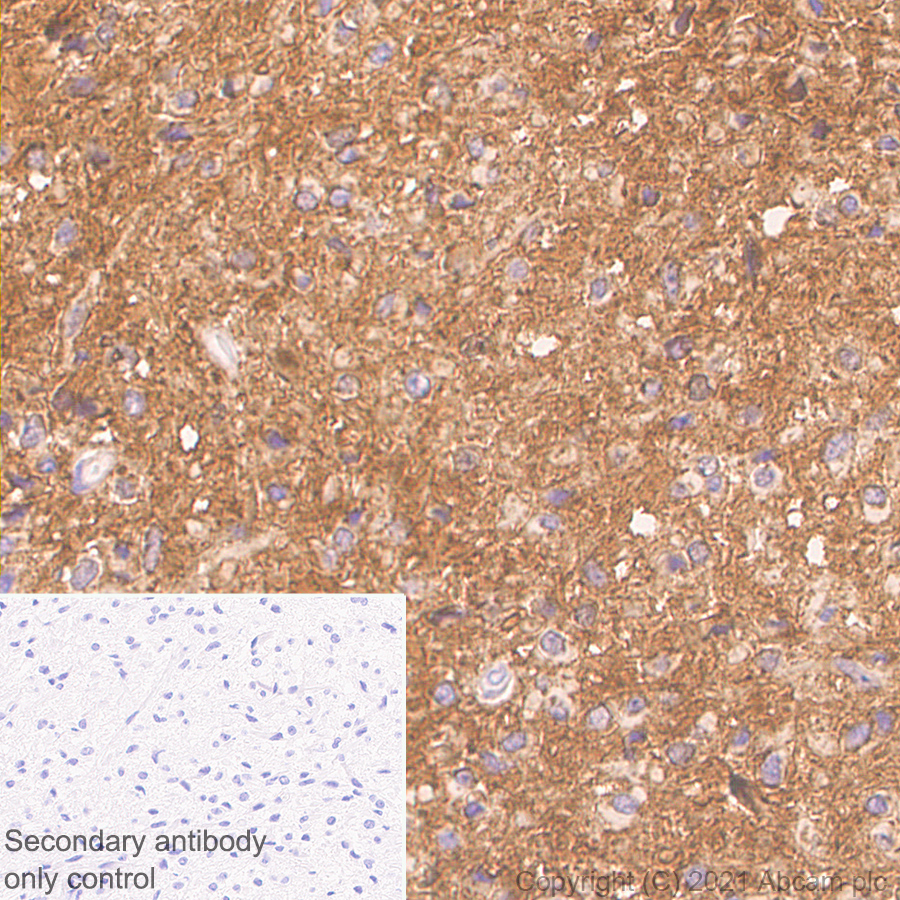 Immunohistochemistry (Formalin/PFA-fixed paraffin-embedded sections) - Anti-PTP zeta/ Phosphacan antibody [EPR26270-86] (AB290640)