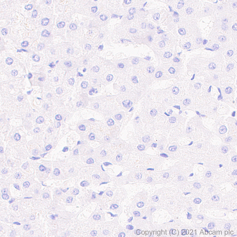 Anti-PTP zeta/ Phosphacan antibody [EPR26270-86] (ab290640) | Abcam