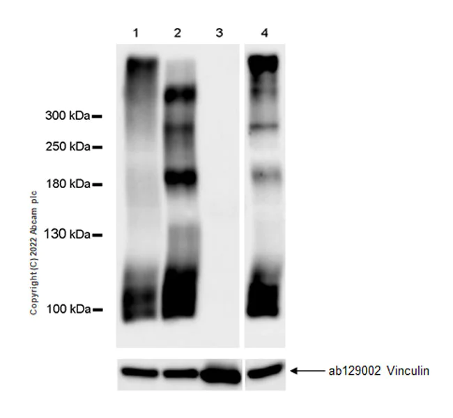 Western blot - Anti-PTP zeta/ Phosphacan antibody [EPR26270-86] (AB290640)
