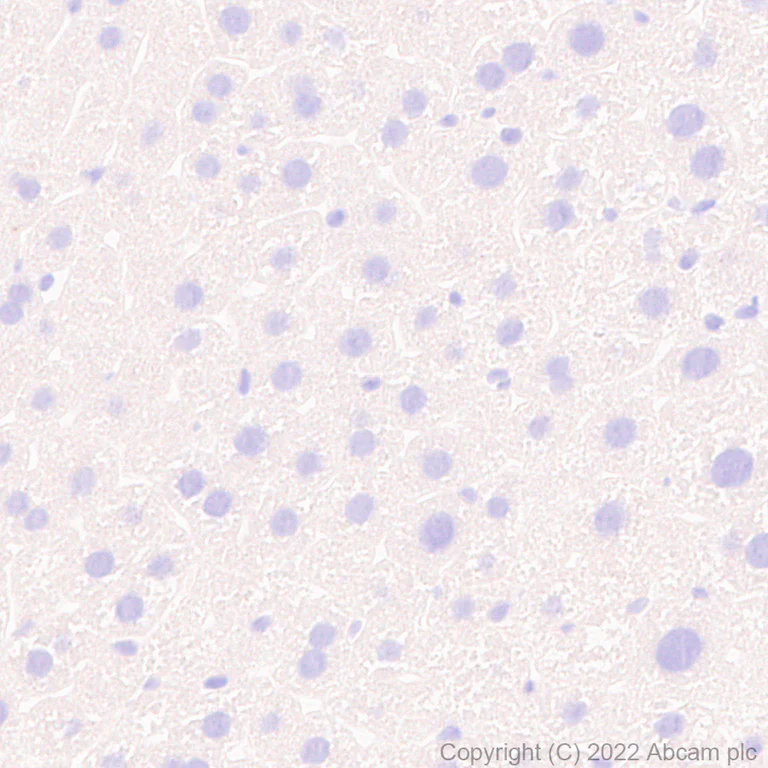 Immunohistochemistry - Anti-PTP zeta/ Phosphacan antibody [EPR26271-75] (AB302790)