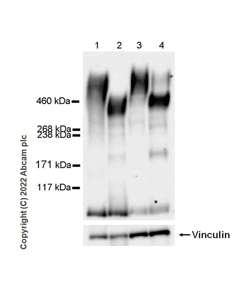 Western blot - Anti-PTP zeta/ Phosphacan antibody [EPR26271-75] - BSA and Azide free (AB302791)