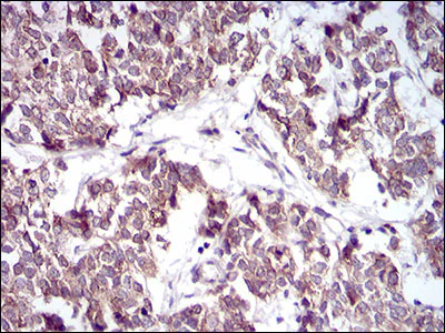 Immunohistochemistry (Formalin/PFA-fixed paraffin-embedded sections) - Anti-PTP1B antibody [4F8F11] (AB201974)