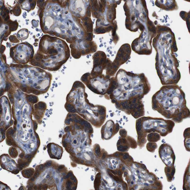 Immunohistochemistry (Formalin/PFA-fixed paraffin-embedded sections) - Anti-PTP1B antibody (AB244328), expandable thumbnail