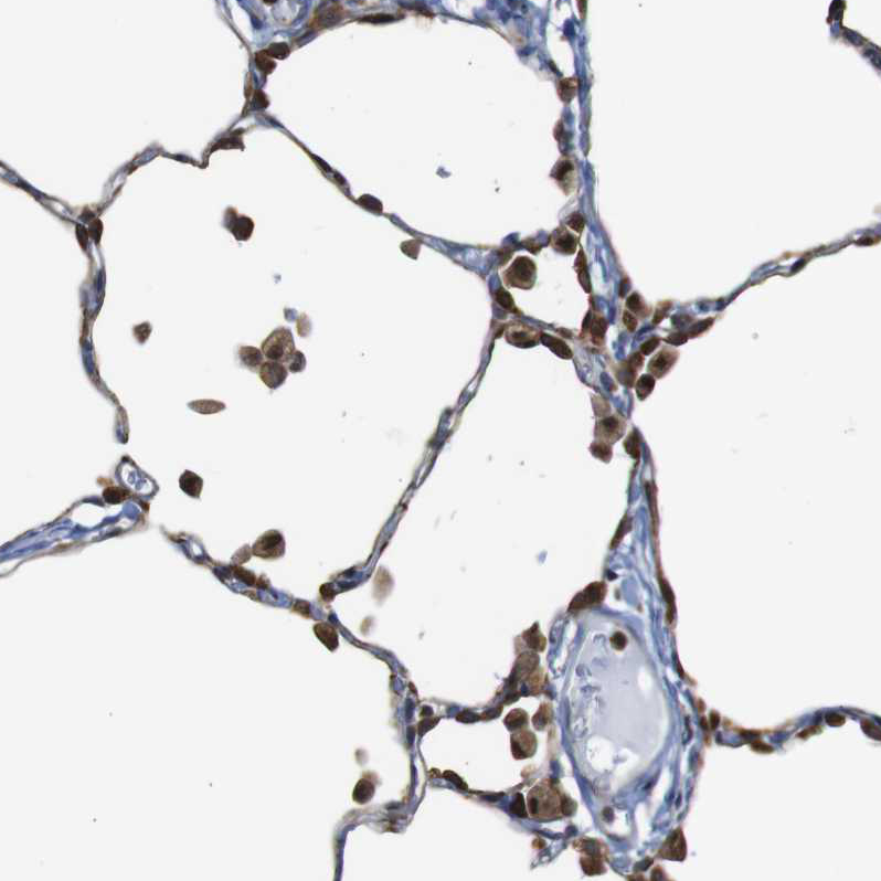 Immunohistochemistry (Formalin/PFA-fixed paraffin-embedded sections) - Anti-PTP1B antibody (AB244328), expandable thumbnail