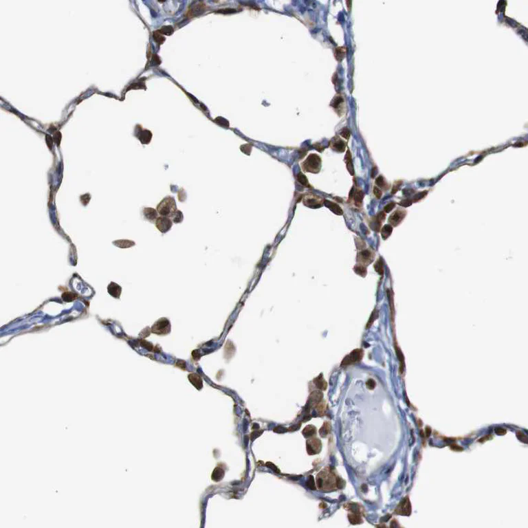 Immunohistochemistry (Formalin/PFA-fixed paraffin-embedded sections) - Anti-PTP1B antibody (AB244328)