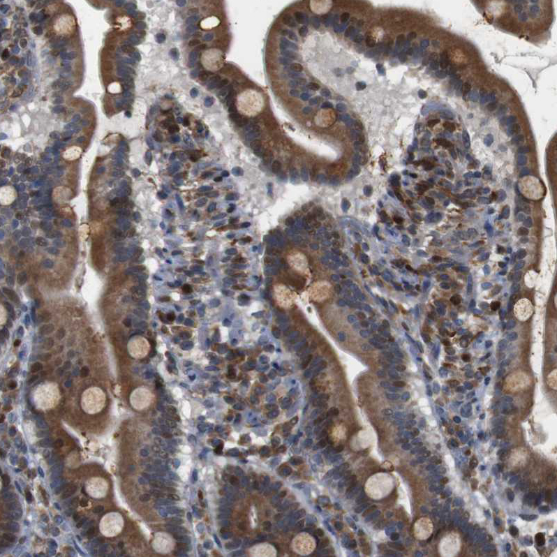 Immunohistochemistry (Formalin/PFA-fixed paraffin-embedded sections) - Anti-PTP1B antibody (AB244328), expandable thumbnail
