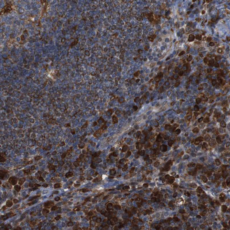 Immunohistochemistry (Formalin/PFA-fixed paraffin-embedded sections) - Anti-PTP1B antibody (ab244328), expandable thumbnail