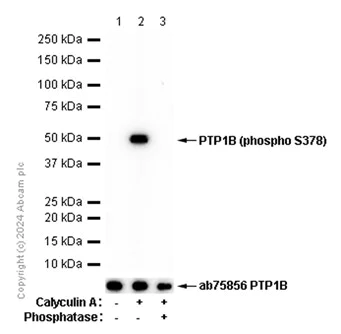 Western blot - Anti-PTP1B antibody [EP1841Y] (AB75856)