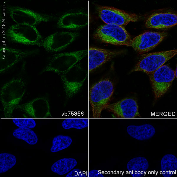 Immunocytochemistry/ Immunofluorescence - Anti-PTP1B antibody [EP1841Y] - BSA and Azide free (AB238956)