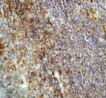 Immunohistochemistry (Formalin/PFA-fixed paraffin-embedded sections) - Anti-PTP1B antibody [EP1841Y] - BSA and Azide free (AB238956)