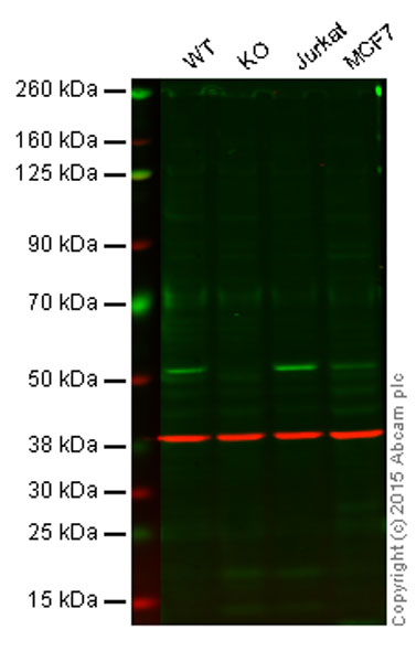 Western blot - Anti-PTP1B antibody [EPR1836(2)] (AB133244), expandable thumbnail