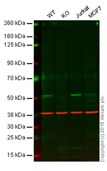 Western blot - Anti-PTP1B antibody [EPR1836(2)] (AB133244)