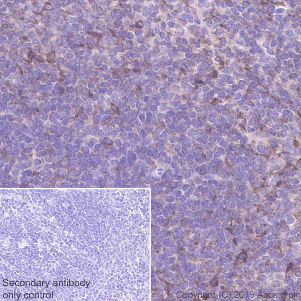 Immunohistochemistry (Formalin/PFA-fixed paraffin-embedded sections) - Anti-PTP1B antibody [EPR22468-6] (ab252928), expandable thumbnail