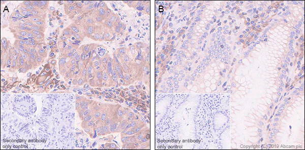 Immunohistochemistry (Formalin/PFA-fixed paraffin-embedded sections) - Anti-PTP1B antibody [EPR22468-6] (AB252928)