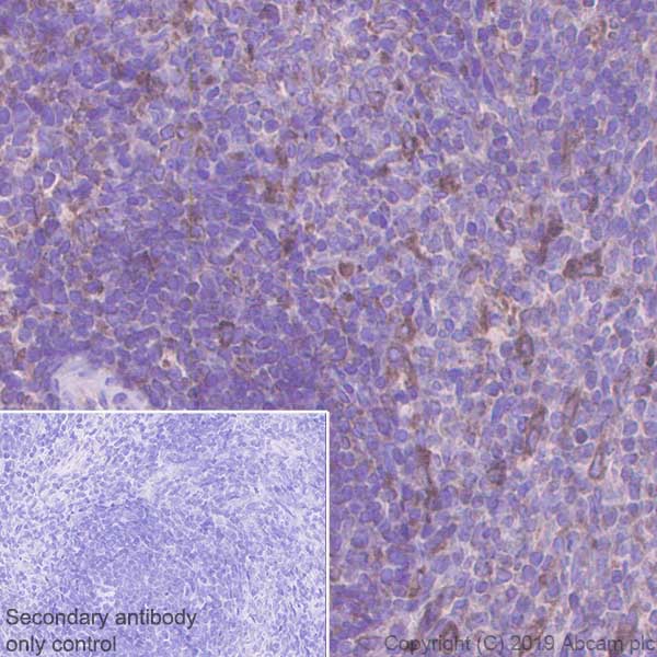 Immunohistochemistry (Formalin/PFA-fixed paraffin-embedded sections) - Anti-PTP1B antibody [EPR22468-6] (ab252928), expandable thumbnail