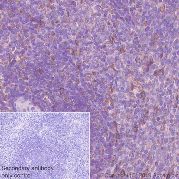 Immunohistochemistry (Formalin/PFA-fixed paraffin-embedded sections) - Anti-PTP1B antibody [EPR22468-6] (AB252928)