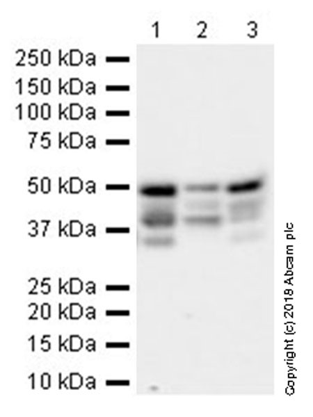 Western blot - Anti-PTP1B antibody [EPR22474] (ab244207), expandable thumbnail