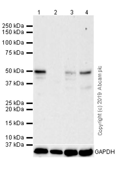 Western blot - Anti-PTP1B antibody [EPR22474] (ab244207), expandable thumbnail