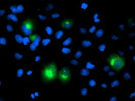 Immunocytochemistry/ Immunofluorescence - Anti-PTP1B antibody [OTI1D10] (AB124375)