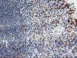 Immunohistochemistry (Formalin/PFA-fixed paraffin-embedded sections) - Anti-PTP1B antibody [OTI1D10] (AB124375)