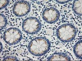 Immunohistochemistry (Formalin/PFA-fixed paraffin-embedded sections) - Anti-PTP1B antibody [OTI1D10] (AB124375)