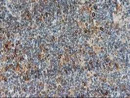 Immunohistochemistry (Formalin/PFA-fixed paraffin-embedded sections) - Anti-PTP1B antibody [OTI1D10] (AB124375)