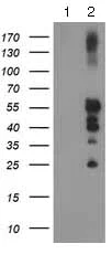 Western blot - Anti-PTP1B antibody [OTI1D10] (AB124375)