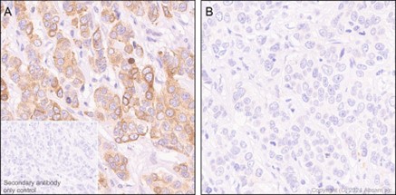 Immunohistochemistry (Formalin/PFA-fixed paraffin-embedded sections) - Anti-PTP1B (phospho S378) antibody [EP1840Y] (AB76239)