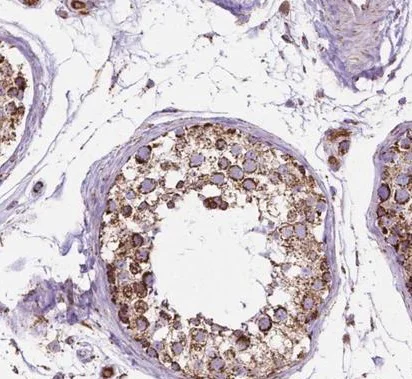 Immunohistochemistry (Formalin/PFA-fixed paraffin-embedded sections) - Anti-PTPIP51 antibody (AB224081)