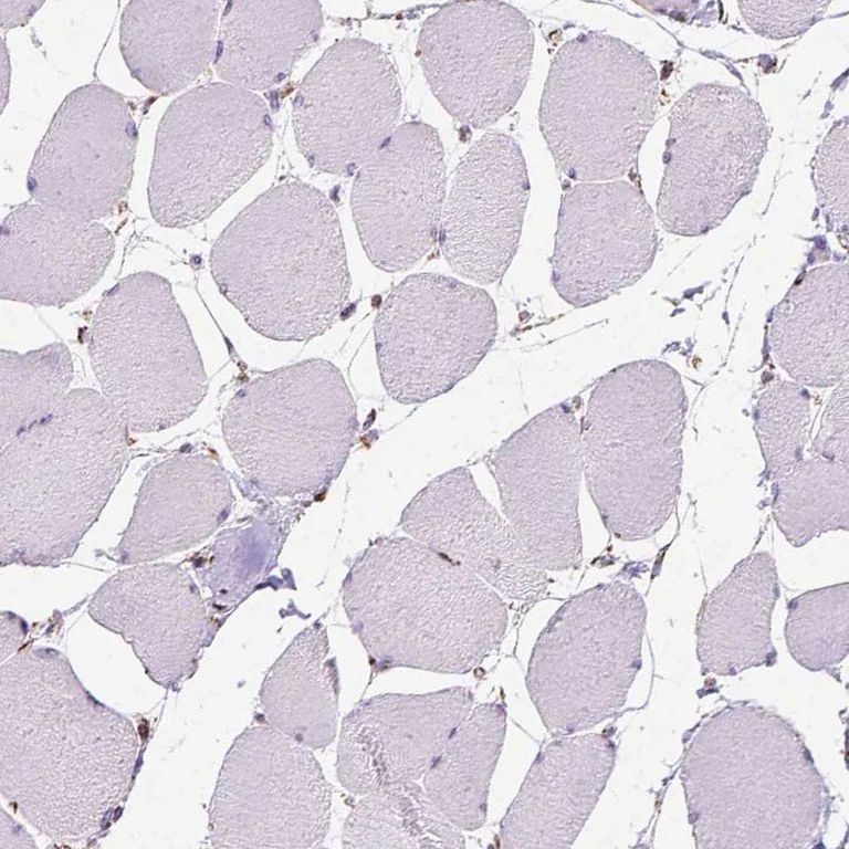 Immunohistochemistry (Formalin/PFA-fixed paraffin-embedded sections) - Anti-PTPIP51 antibody (AB224081)