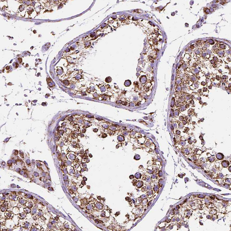 Immunohistochemistry (Formalin/PFA-fixed paraffin-embedded sections) - Anti-PTPIP51 antibody (AB224081), expandable thumbnail