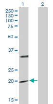 Western blot - Anti-PTPMT1 antibody (AB168479)