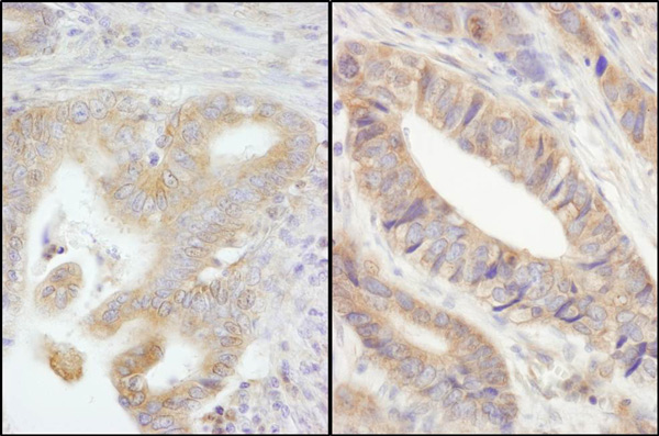 Immunohistochemistry (Formalin/PFA-fixed paraffin-embedded sections) - Anti-PTPN12 antibody (AB76942)