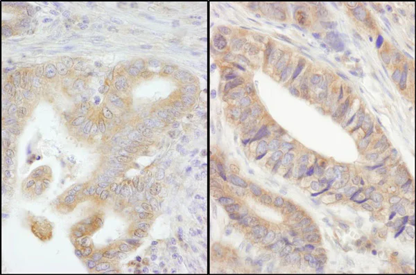 Immunohistochemistry (Formalin/PFA-fixed paraffin-embedded sections) - Anti-PTPN12 antibody (AB76942)