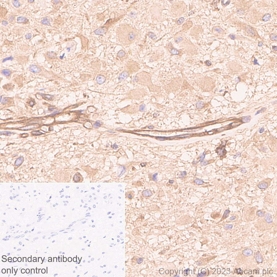 Immunohistochemistry (Formalin/PFA-fixed paraffin-embedded sections) - Anti-PTPN12 antibody [EPR28198-148] (AB315338), expandable thumbnail