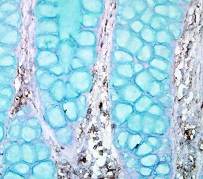 Immunohistochemistry (Formalin/PFA-fixed paraffin-embedded sections) - Anti-PTPN12 antibody - N-terminal (AB154892)