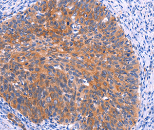 Immunohistochemistry (Formalin/PFA-fixed paraffin-embedded sections) - Anti-PTPN13/FAP-1 antibody (AB198882)