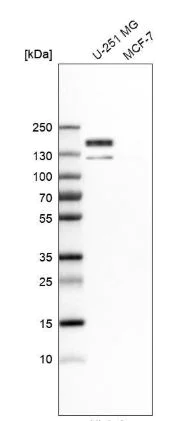 Western blot - Anti-PTPN14 antibody (AB204321)