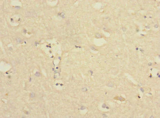 Immunohistochemistry (Formalin/PFA-fixed paraffin-embedded sections) - Anti-PTPN18 antibody (AB230300)